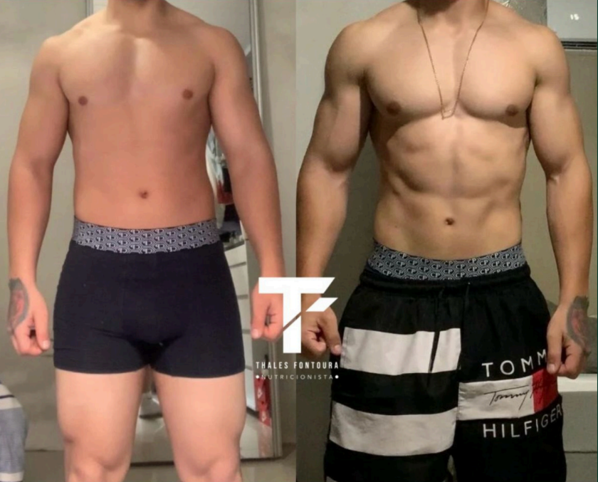 Hipertrofia masculina